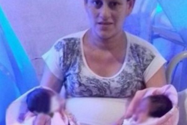 Versiones cruzadas ante un parto múltiple en el Hospital Vidal
