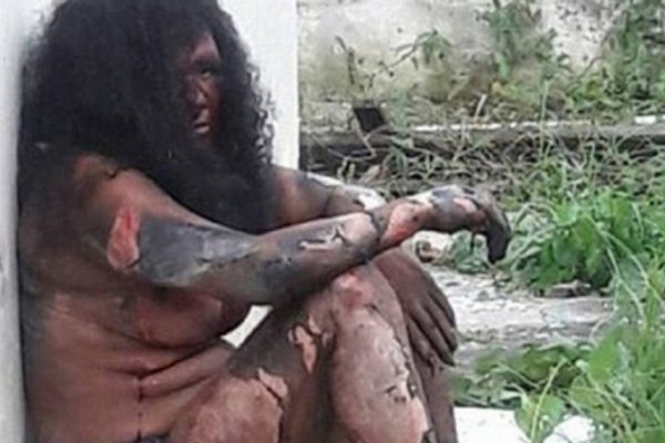 Quemaron viva a una embarazada acusada de matar a un niño
