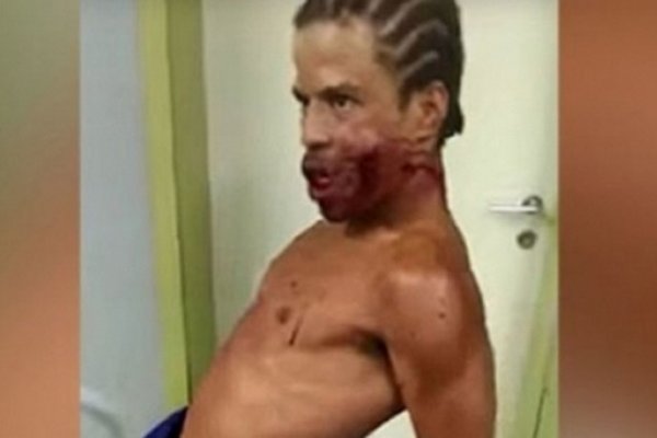Terror en un hospital de Río por un hombre poseído