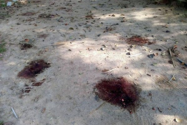 Joven grave tras ser baleado y apuñalado en Esquina