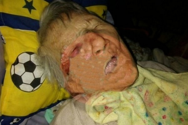 Abuela de 80 años fue golpeada por su ex pareja en el barrio Apipé