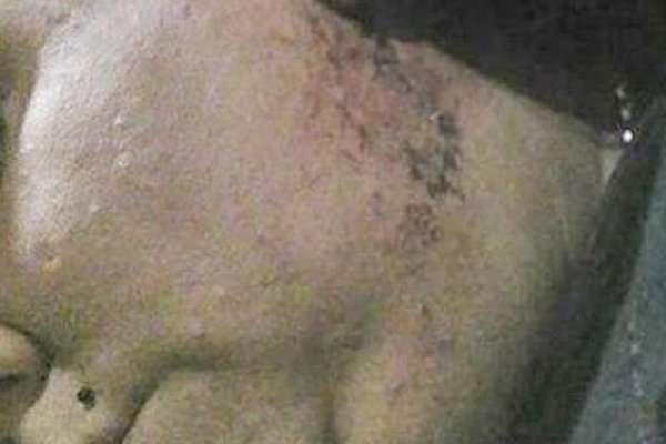 Mujer golpeada logró una perimetral para que su ex pareja no se acerque