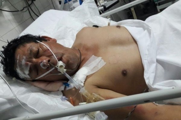 Difunden imagen de un hombre NN atropellado: Buscan a familiares