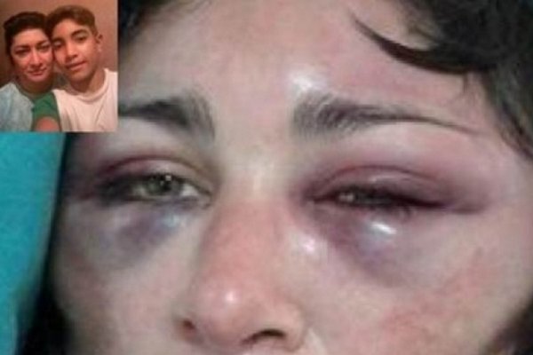 Santo Tomé: Detuvieron al hombre que molió a golpes a su ex