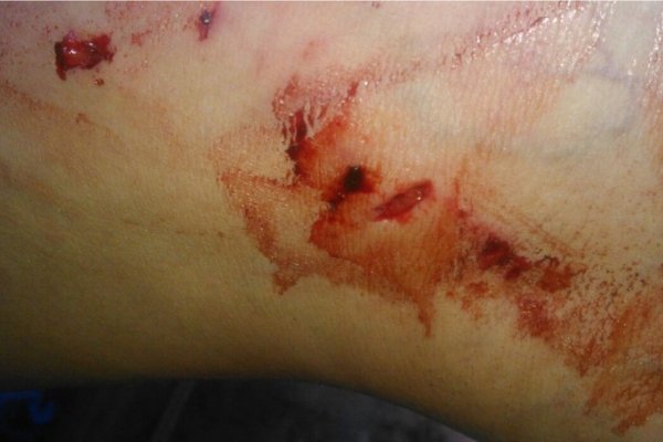 Violencia de género: Fue atacada por su hermanastro y en la comisaría no le quisieron tomar la denuncia