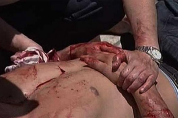 Apuñalaron a un trapito del cementerio de la ciudad Goya por una discusión por 10 pesos