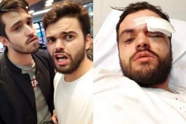 El mensaje del rugbier gay atacado: Lucharé por el fin de la homofobia