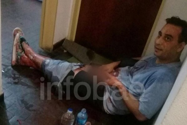 Ella quería revisarme el celular, aseguró el hombre al que le amputaron los genitales