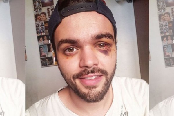 Habló el rugbier agredido por una patota: Pensé que me mataban