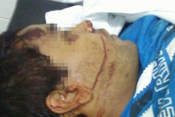 Delincuente con frondoso prontuario murió luego de un fuerte choque entre dos motos