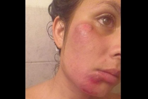 Motomandado manoseó y golpeó brutalmente a una joven