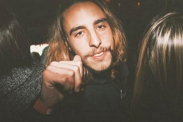 Lo golpearon en Punta del Este: tiene parálisis facial y perdió la audición del oído izquierdo