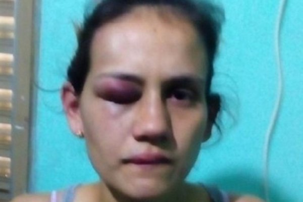 Detienen a un policía luego de propinarle una golpiza a su pareja