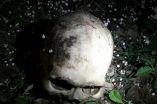 Quitilipi: Vecina encontró un cráneo humano en un baldío