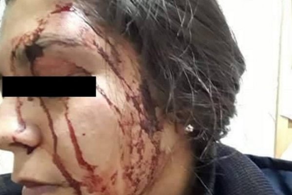 Feroz ataque a mujer policía: Habrían querido robarle el arma
