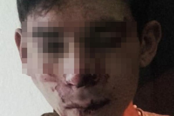 Fuga y muerte en Corrientes: Tiene 18 años uno de los motochorros que causó una tragedia