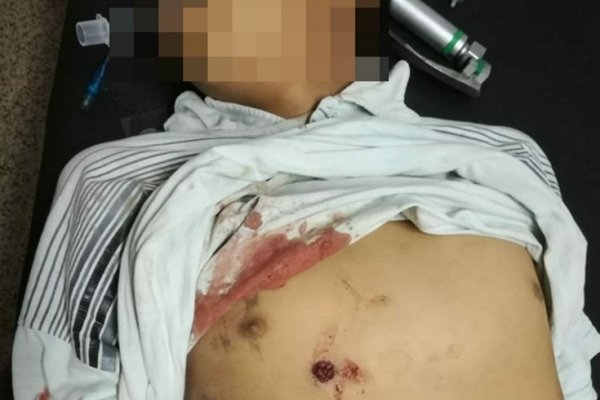 Sáenz Peña: La bala que mató al menor no es de uso policial