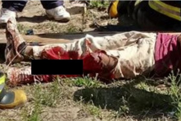 Perdió la pierna el nene de 12 años que se le cayó un muro en Goya