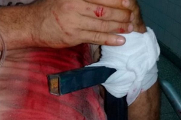 Parte médico del ladrón que saltó una reja y quedó enganchado: Está fuera de peligro