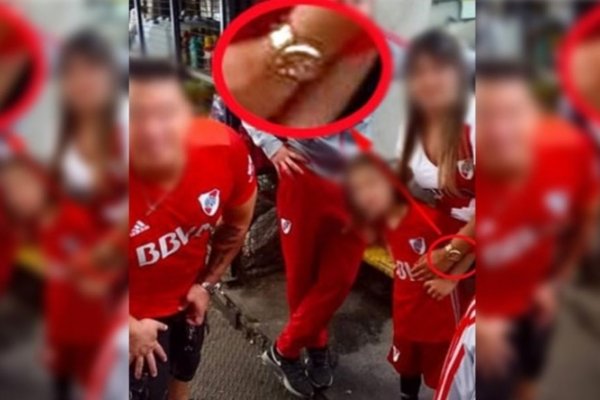 Detuvieron a la mujer que le pegó bengalas al cuerpo de su hijo: La delató su reloj