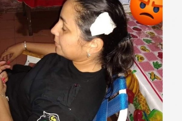 Feroz agresión a mujer policía en un boliche de San Cosme