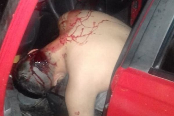 Un hombre fue asesinado a balazos en el barrio La Olla