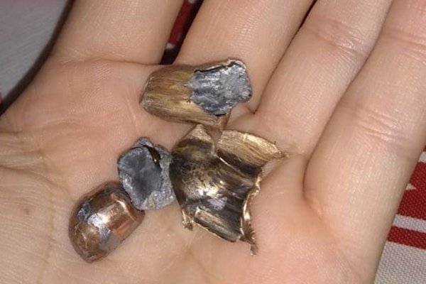 Herido en el barrio La Olla: No hay policías detenidos, sí secuestraron armas de la fuerza