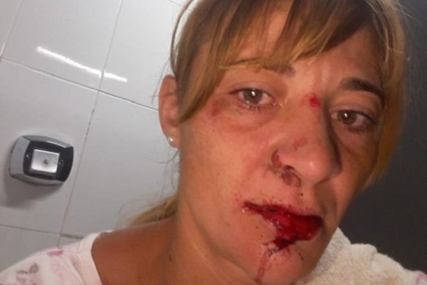 Mujer fue brutalmente atacada por un ladrón en un colectivo: tenía turno para operarse del corazón