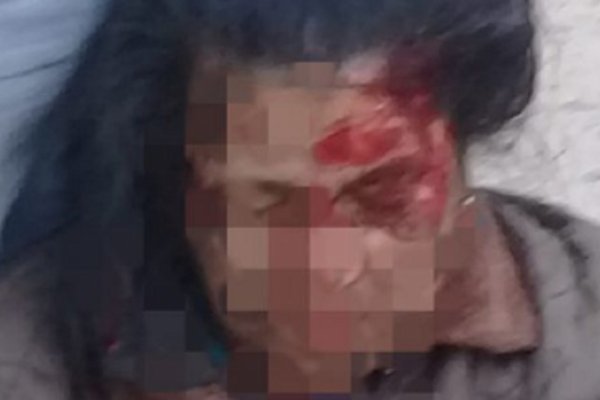 Chocó a una pareja en moto y se dio a la fuga: Una mujer herida