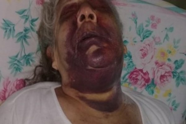Feroz golpiza a una anciana