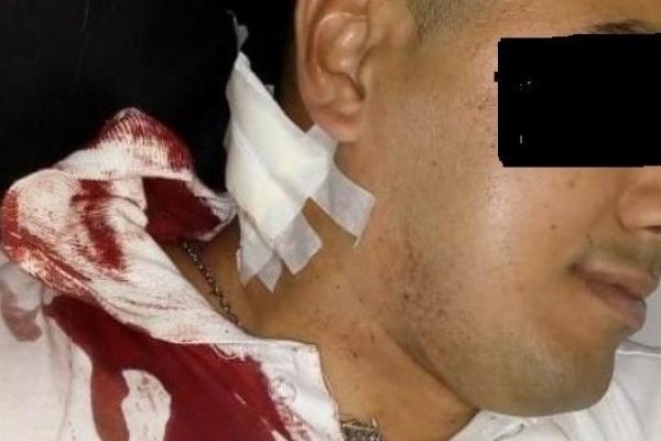 Un policía recibió un botellazo en el cuello