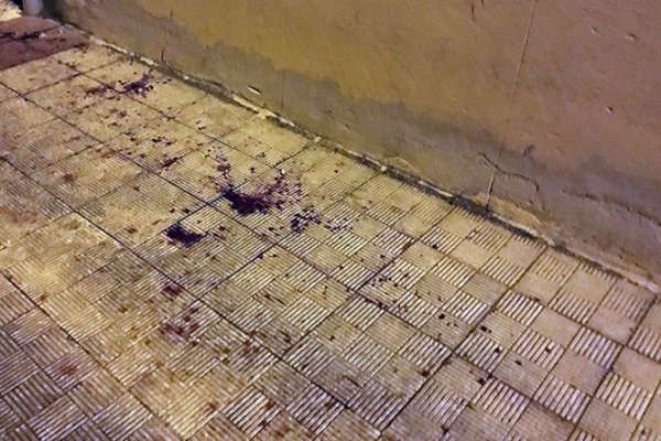 Motochorros atacaron con un hierro a una mujer: Vecinos indignados con la Policía