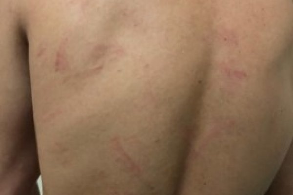 Policias agredieron salvajemente al hijo de Carlos Farizano