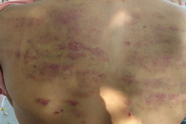 Goya: Castigaban brutalmente a un nene si no vendía churros