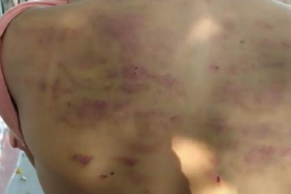 Liberaron al sujeto que golpeaba a su hijastro por no vender churros