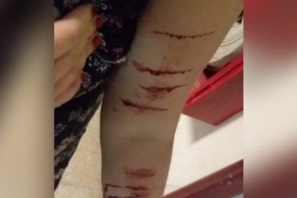 Barrio Pirayuí: Brutal ataque a una mujer por miembros de una familia que atemoriza el barrio