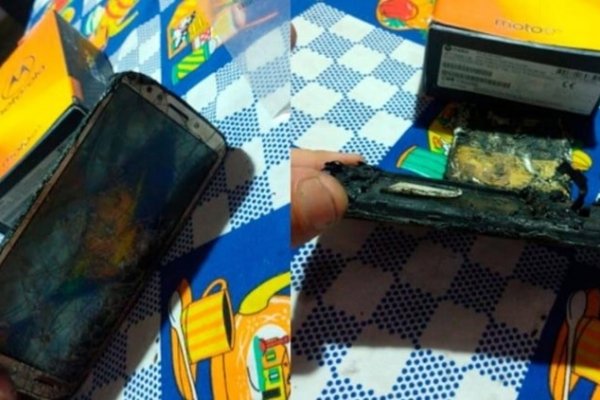 Su celular explotó mientras dormía y sufrió quemaduras en varias partes del cuerpo