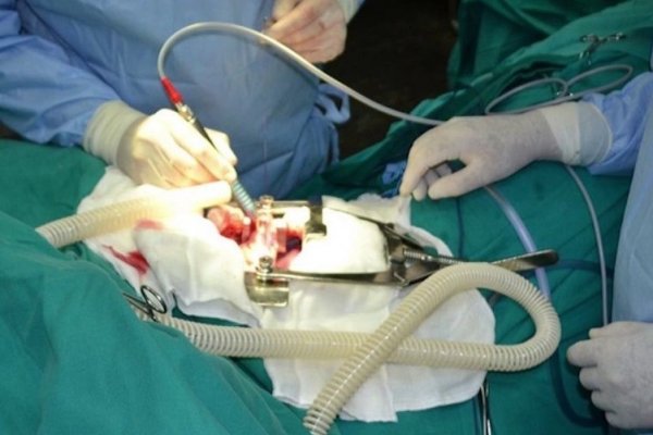 Corrientes contrata servicio del Hospital Aleman para trasplante de médula ósea a paciente sin recursos