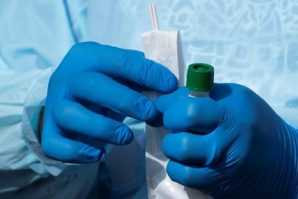 Coronavirus en Argentina: Confirmaron 75 muertes, el número más alto para una jornada