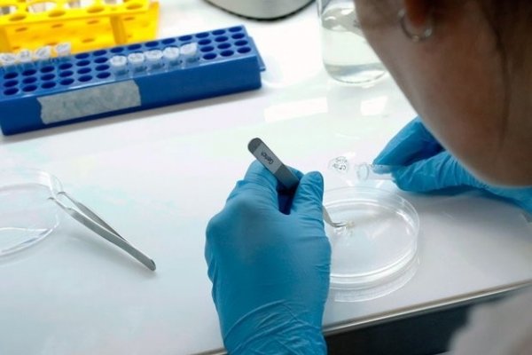 Coronavirus en Argentina: Se registraron 62 muertes y 2.979 contagios en las últimas 24 horas