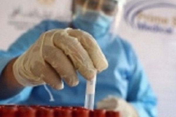 Chaco: Registran 151 fallecidos por coronavirus