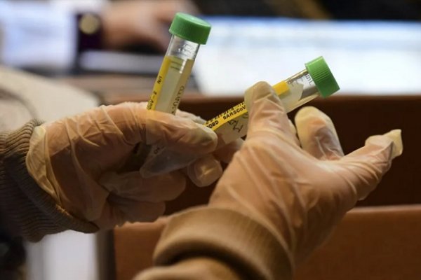 Rusia confirma que el primer lote de la vacuna contra el coronavirus será producido en 2 semanas
