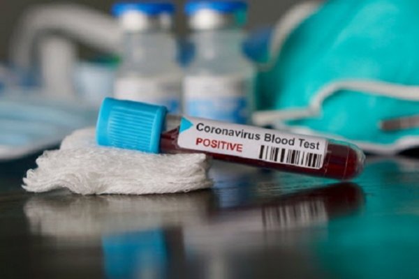 Coronavirus: Corrientes acumula 247 casos positivos