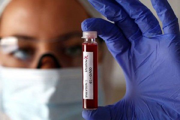 Corrientes suma tres casos nuevos de Coronavirus: En Libres, Itatí y Santa Ana