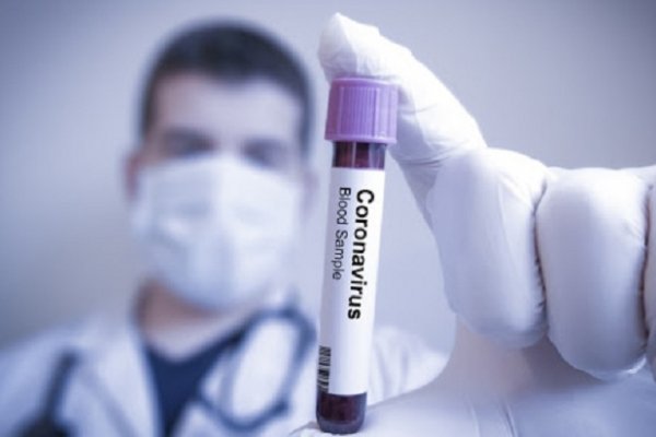 Chaco redujo sus casos activos de Coronavirus a 286