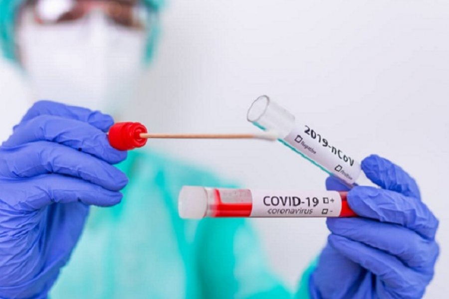 Corrientes reportó 18 casos nuevos de Coronavirus: 15 en Capital y 3 en Santo Tomé