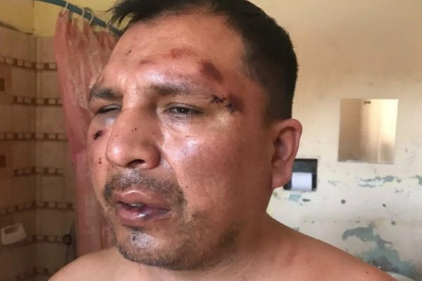 La Policía golpeó a un hombre y lo detuvo por 18 horas
