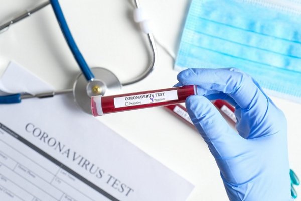 Corrientes superó los 1.000 casos de Coronavirus: Confirman 24 contagios en las últimas horas