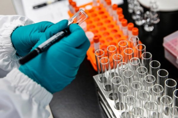 Coronavirus: la Universidad de Oxford probará un fármaco que se usa para artritis  