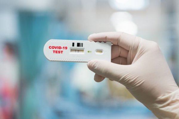 Libres adquirió 500 test con hisopados para detectar Covid-19 en 15 minutos